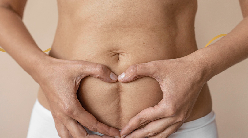 Imagem Revisão de cicatrizes e retirada de lesões de pele<br />
